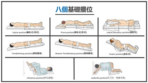 截刀臥位|一位年輕直腸癌個案之 手術全期護理經驗